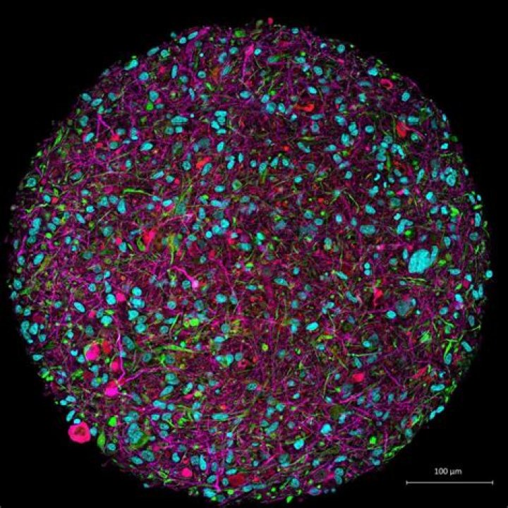 Lab Grown Brain After One Month