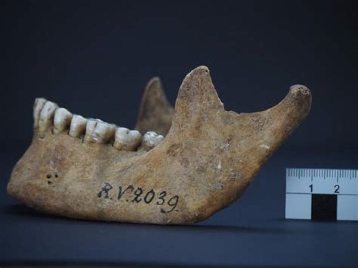 Oldest Plague Victim Teeth
