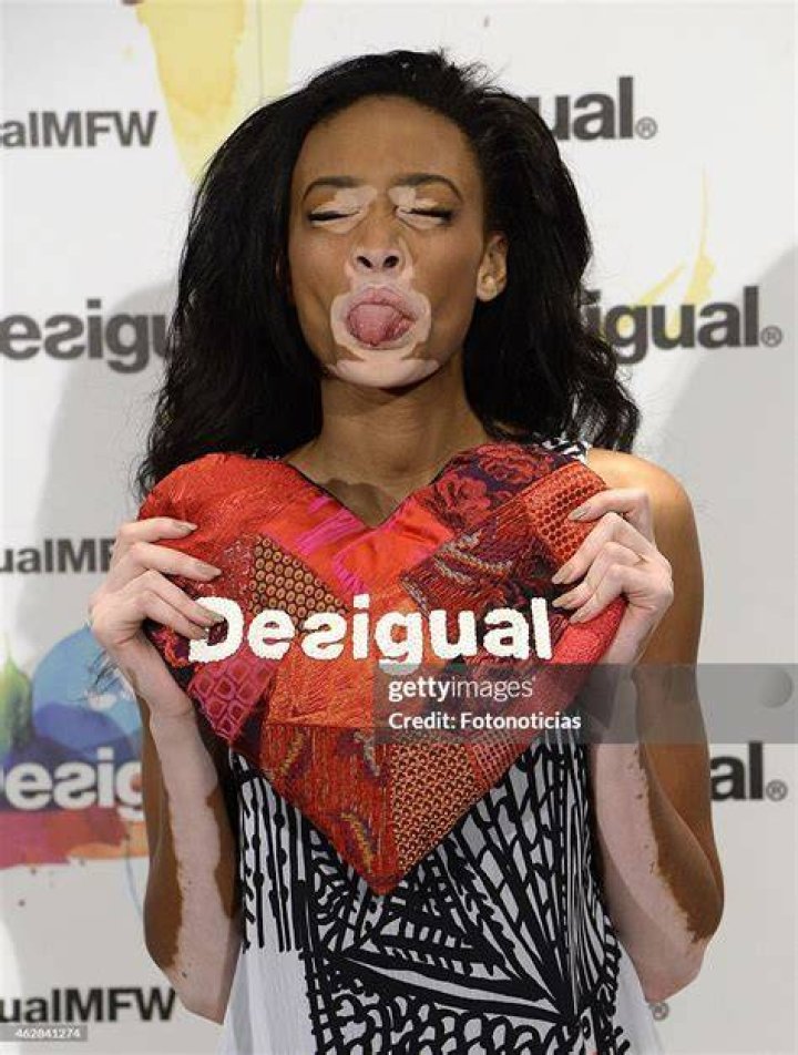 Winnie Harlow Presented as New Desigual Face for the Spring-Summer 2015 Campaign "Say Something Nice"